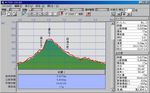 120624鼻の下断面.jpg